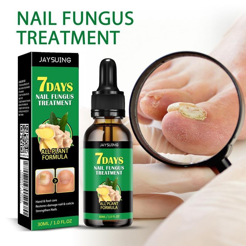 JAYSUING Ginger Nail Treatment|Vitamin E & Plant Essential Oils for Nail Care| Supports Recovery from Onychomycosis, Paronychia, & Nail Deformation | Comforting Manicure & Nail Art Solution Ginger Nail Nourishing Smooth