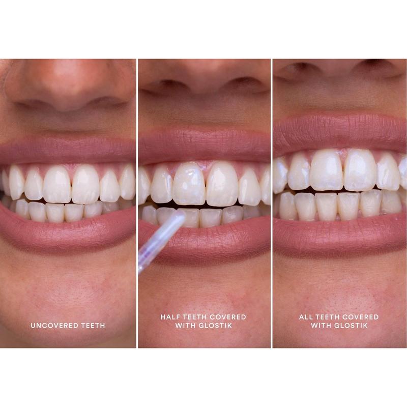 Hismile Glostik Tooth Gloss - Instantly Brighter Teeth, Temporary Tooth Gloss, Gloss Results