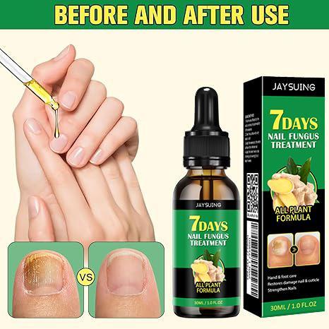 [2 Packs Only $12.99] JAYSUING Ginger Nail Care Serum, Moisturizes, Strengthen and Thickens Nails