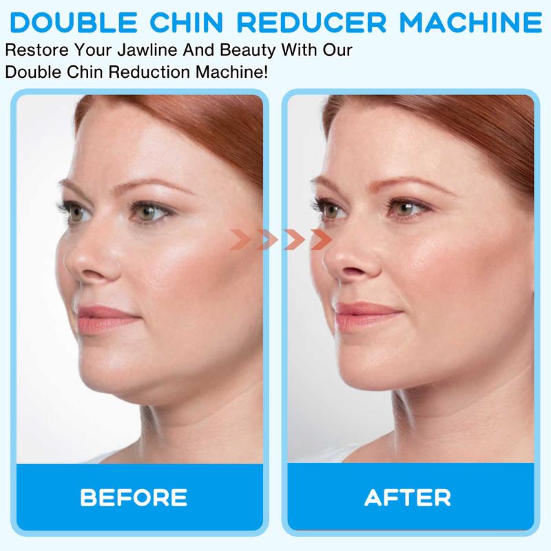 Electric Double Chin Device and V-Face Machine with 8 Modes and 15 Gear Adjustable Intensities - Intelligent Double Chin Machine for V-face