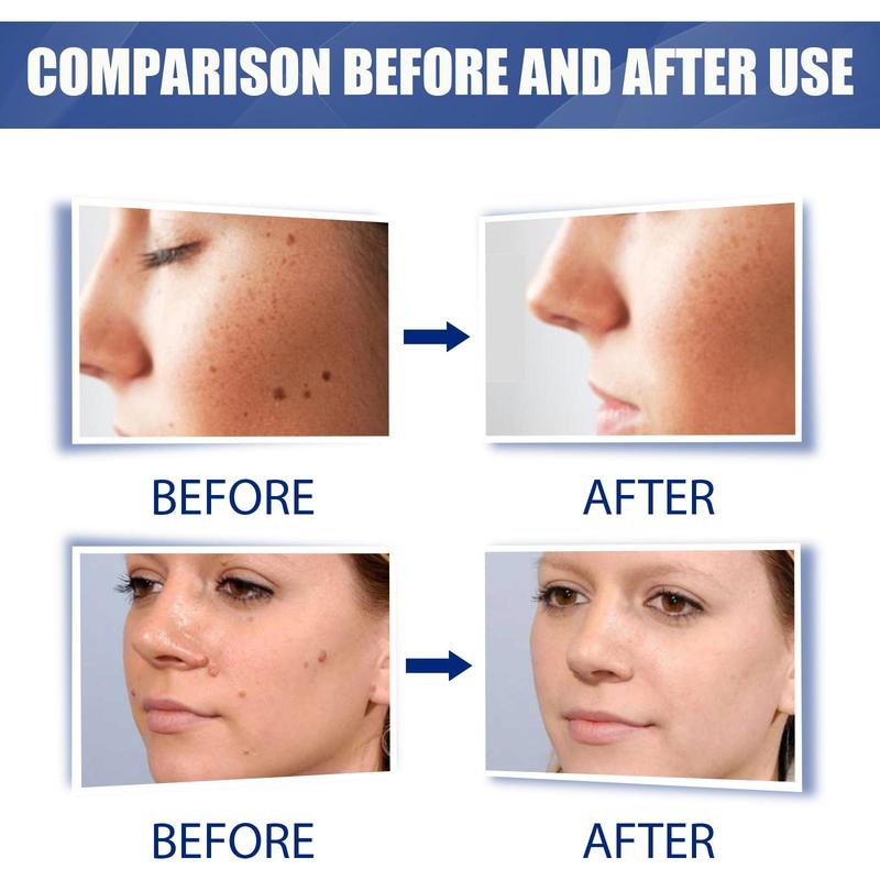 JAYSUING  Skin Label Removal Cream - Corneous Warts Flat Removal Cleansing Skin Kayu Cream - Moisturizers Skincare Smooth