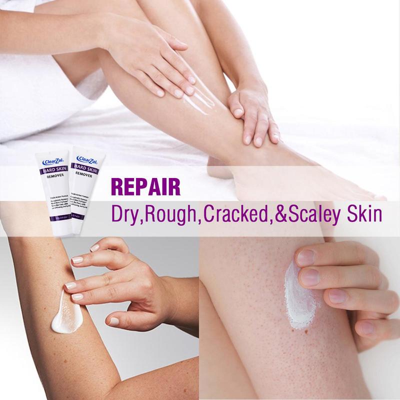 ClearZal targets chicken skin on arms and legs and enlarged pores,  improves it, and can be used all over the body Triple action formula exfoliates old skin cells 3.4 Ounce Body Care Cosmetic