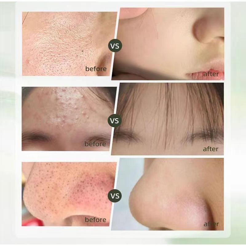 M Centella Asiatica Facial CleanserCleansing Oil Facial Makeup RemoverSet to Remove Pore Scratches, SkinCare Oil Cosmetic Facial Cleansing centella  asiatica