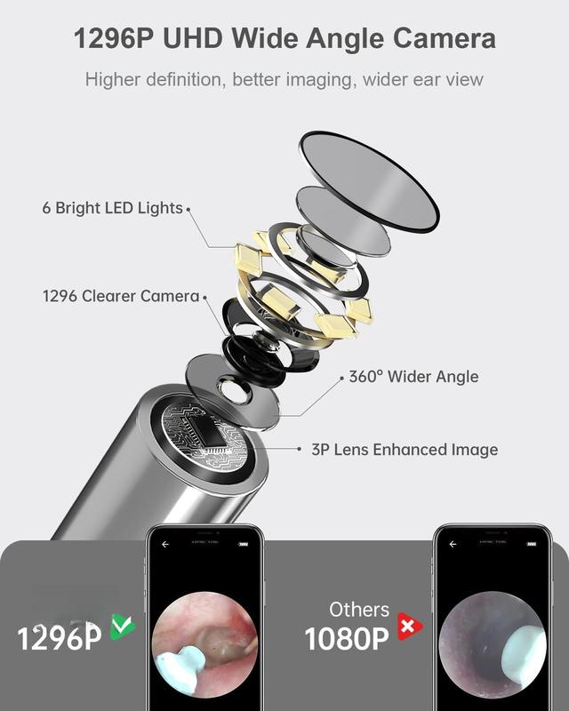 Ear Wax Removal Tool Camera, Ear Cleaner with Camera 1296P, Ear Camera Wax Removal with 6 LED Light, Ear Cleaning Kit, Earwax Remover with Camera Otoscope for  iOS iPad Android (Black)