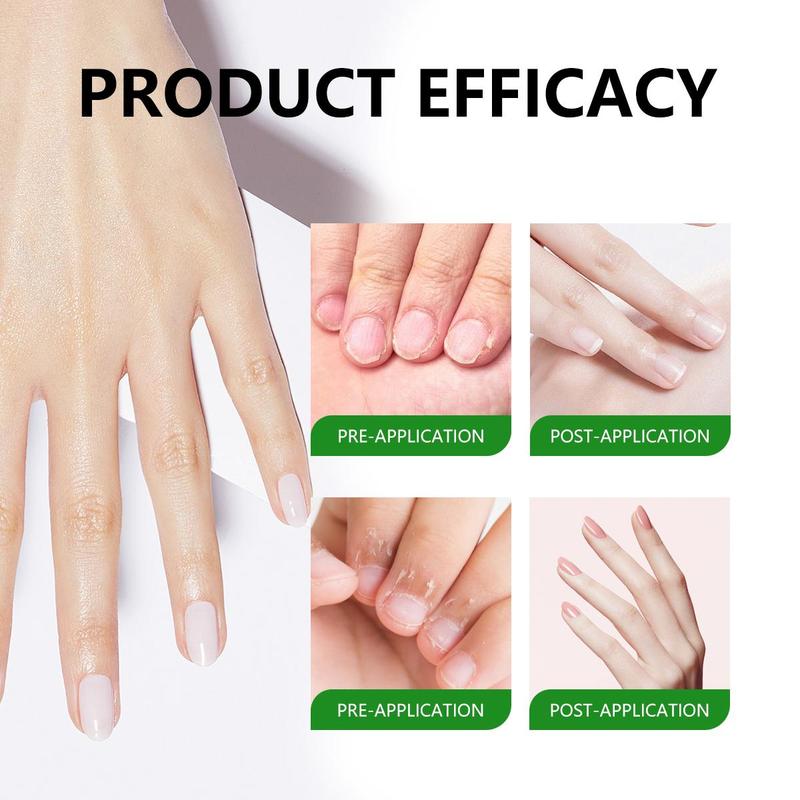 [Only $5.99!!!] Toenail Fungus Treatment Extra Strength Fluids,Fungus Nail Treatment  ,Transform Your Toenails with Ease