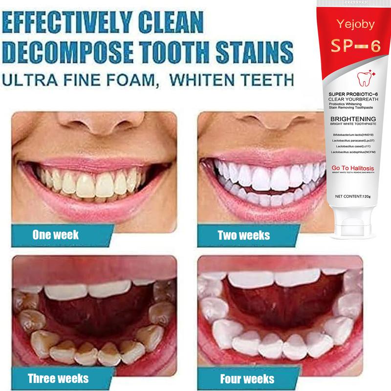 [+5$Get 2Pcs] SP-6 Toothpaste Oral Health Management, Fresh Breath SP-8 SP-4