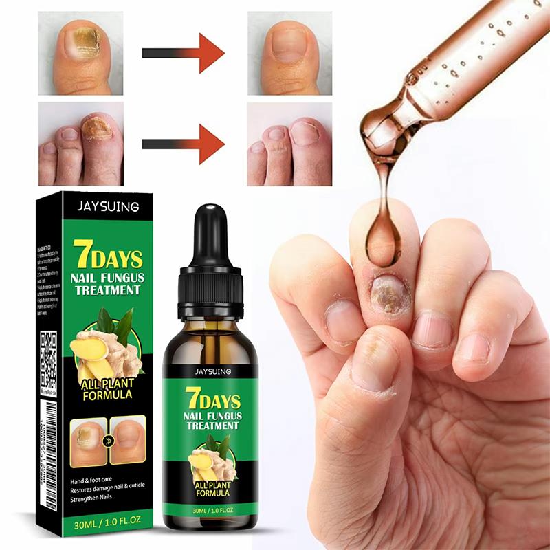 Multi-Purpose Nail Repair, Nail Solution for Discolored and Damaged Nails