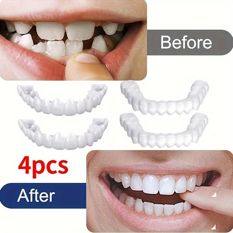 4-Pack Soft Adjustable Denture Veneers Set - White Upper and Lower Components for All Men and Women, Easy to Clean, Comfortable, and Restores Natural Smile