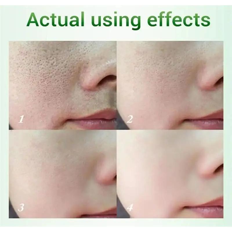 Salicylic Acid Pore Shrinking Cream Quick Elimination Large Pores Remove Blackehead Tighten Face Smooth Skin Korean Care Product