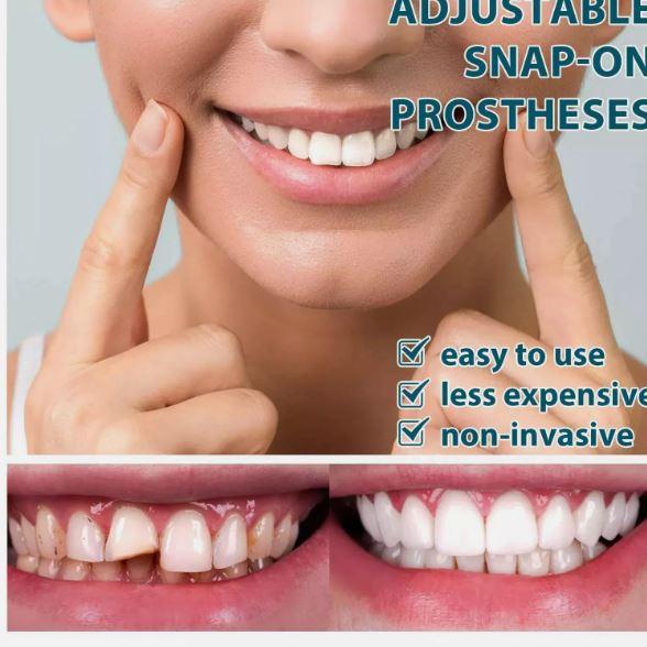 Snap On Upper and Bottom Set False Teeth Dental Veneers Denture Tooth Cover,Moldable False Teeth for Beautiful Smile