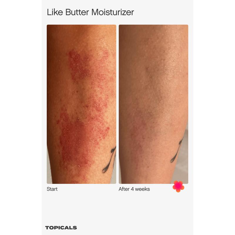 Like Butter Moisturizer with 1% Colloidal Oatmeal, Centella, & Turmeric – Intensive Care for Dry, Eczema-Prone Skin