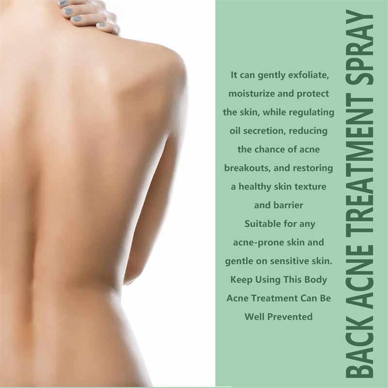 Back Acne Treatment Spray, Herbaluxy Back Acne spray, Anti Acne Marks Spot Removal Serum Moisturizing, Acne Treatment for Clear Back and Body Acne Moisture Skincare Gentle Sensitive Moisturizer Moisturize Hydrating Skin Repair