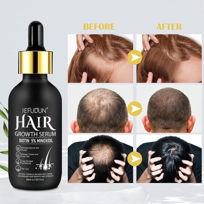 2 Pack Sefudun - 5% Minoxidil Hair Growth Serum, Minoxidil For Men and Women Hair, 60ml Biotin Hair Regrowth Serum Treatment, Topical Serum for Scalp Hair Care, Getting Thicker Healthier Hair