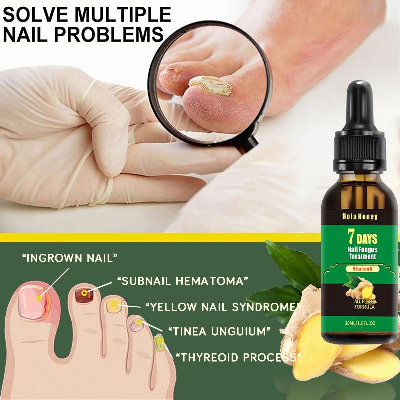 Hola Honey 7 Days Ginger Nail , moisturizes and thickens nails - longer, stronger and brighter nails with vitamins B and E[zjxhy809cy01]