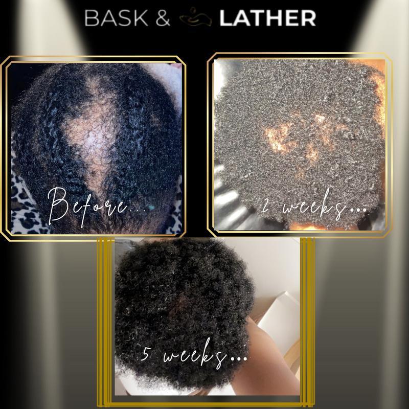 Scalp Stimulator | Hair Growth Oil