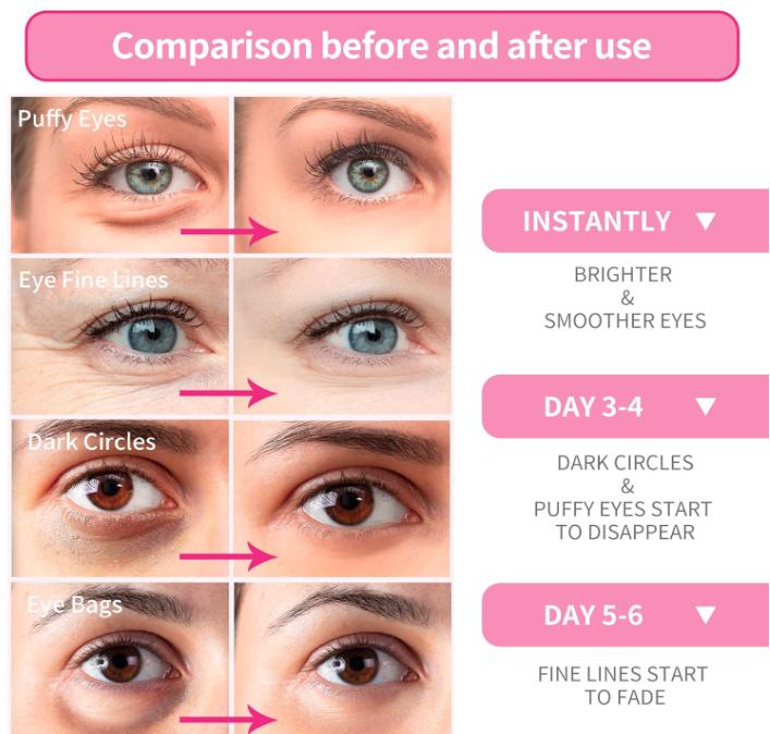 BREYLEE Rose Eye Mask– 60 Pcs - Eye Treatment Mask, Under Eye Bags Treatment, Under Eye Masks, Under eye Dark Circles