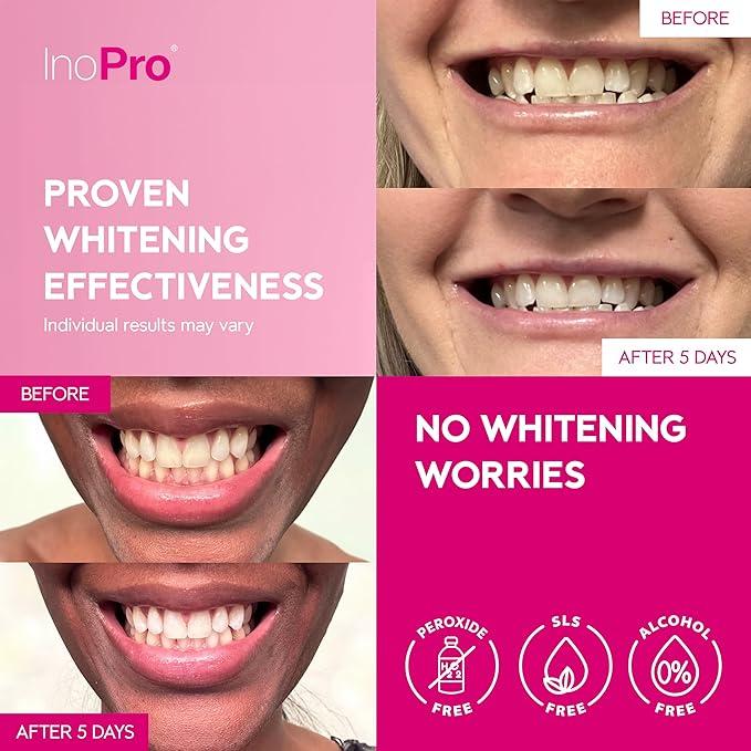 INOPRO Teeth Whitening - Teeth Whitening Strips 14 Treatments Kit guru whitening strips total smile nonslip whitening coconut whitening Oral dental tool beautiful smile