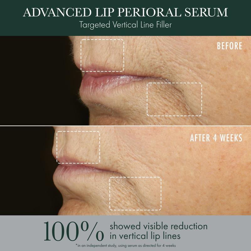 Advanced Lip Perioral Serum   Targeted Vertical Line Filler