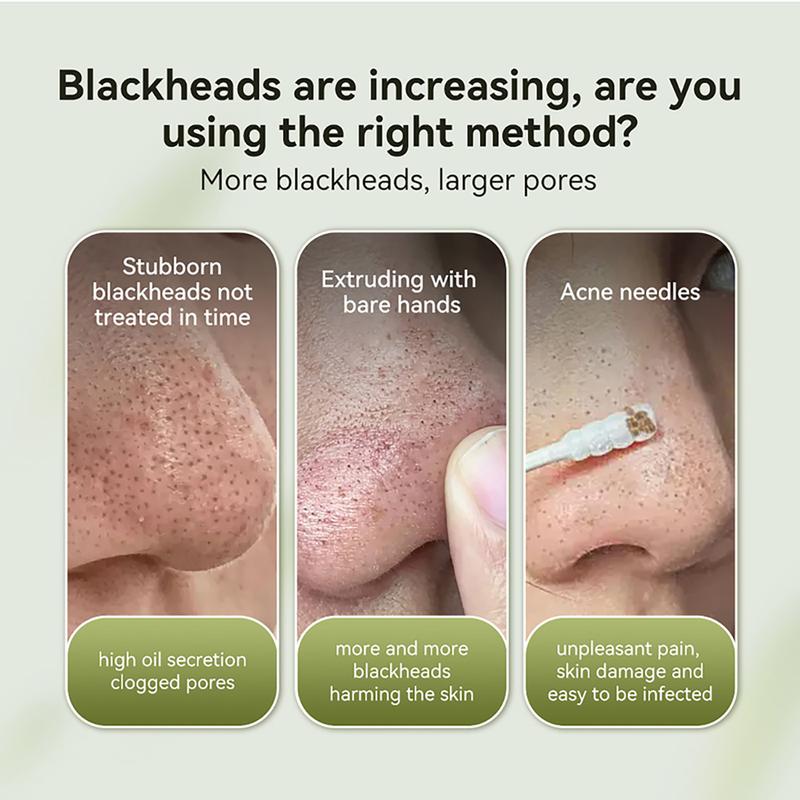 LANBENA Blackhead Remover Mask New 2.0 version Softening keratin, unclogging pores, deep cleansing,  soothing the skin，50g version