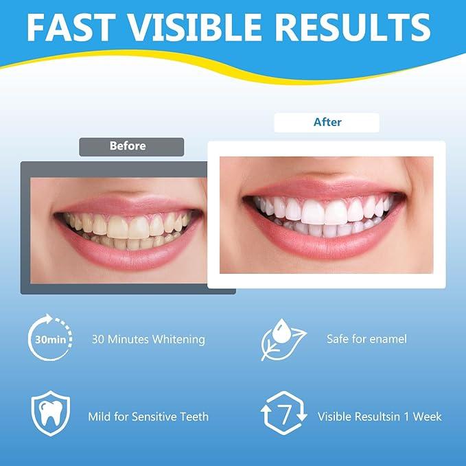 Teeth Strips,Whitening Strips for Teeth Dental Stickers 5D Dazzling White Stickers   Brightening Stickers Oral Gentle