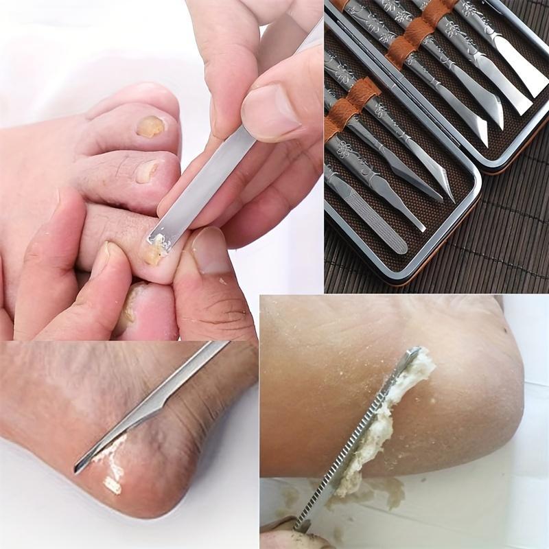 Stainless Steel Foot File, 8 Counts set Portable Foot Dead Skin Remover, Callus Remover, Pedicure Tool for Home & Salon Use