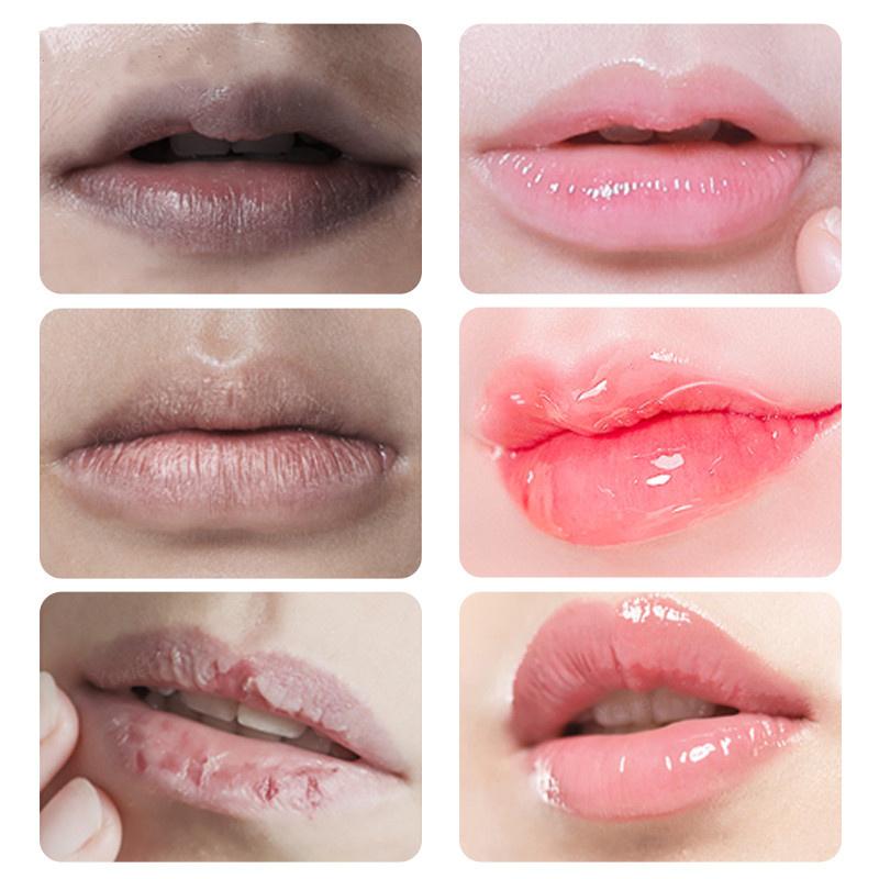 Lips Pink Fresh Lightening Bleaching Cream Reduce Pigmentation Remove Dark Smoke Lips GLow Moisturizer Essence Lip Care