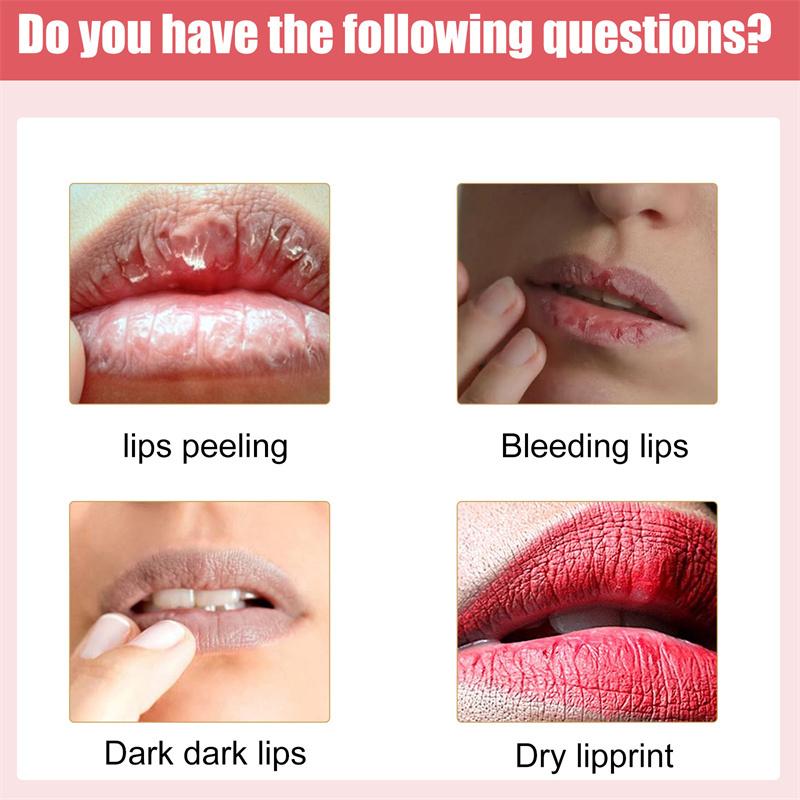 Lips Pink Fresh Lightening Bleaching Cream Reduce Pigmentation Remove Dark Smoke Lips GLow Moisturizer Essence Lip Care