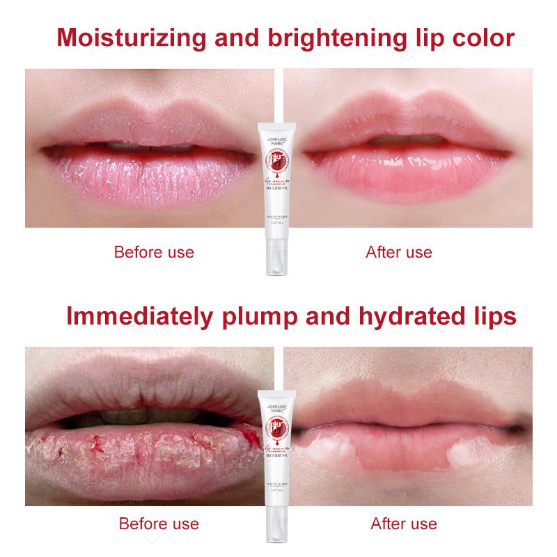 Lips Pink Fresh Lightening Bleaching Cream Reduce Pigmentation Remove Dark Smoke Lips GLow Moisturizer Essence Lip Care