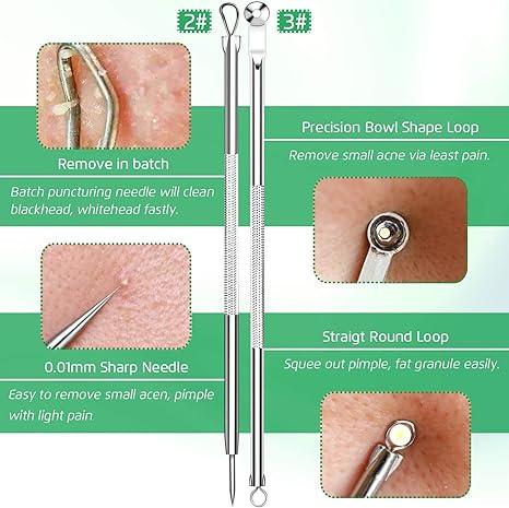 5PCS Blackhead Remover Comedone Extractor, Curved Blackhead Tweezers Kit, Pimple Acne Blemish Removal Tools Kit. ear blackhead removal products