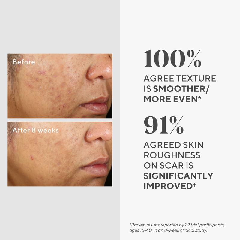 InvisiScar Resurfacing Acne Scar Treatment Serums Skincare