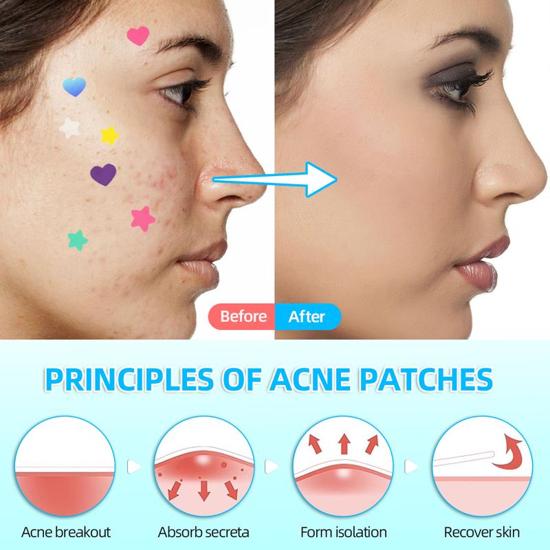 Hydrocolloid Acne Patches for Face - 2 Sizes (240pcs Star Patch, 216pcs Love Patch) Witch Hazel & Tea Tree Oil - Skincare for Skin Repair