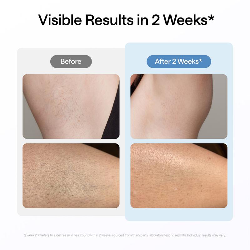 [Exclusive] Ulike Laser Hair Removal, Dual Light, Air 10 IPL Hair Removal for Women and Men, 65°F Ice-Cooling Contact, Skin Sensor & SHR Mode for Nearly Painless, Effective & Long-Lasting Hair Removal from Home, Silver-White, Exclusive in TikTokShop