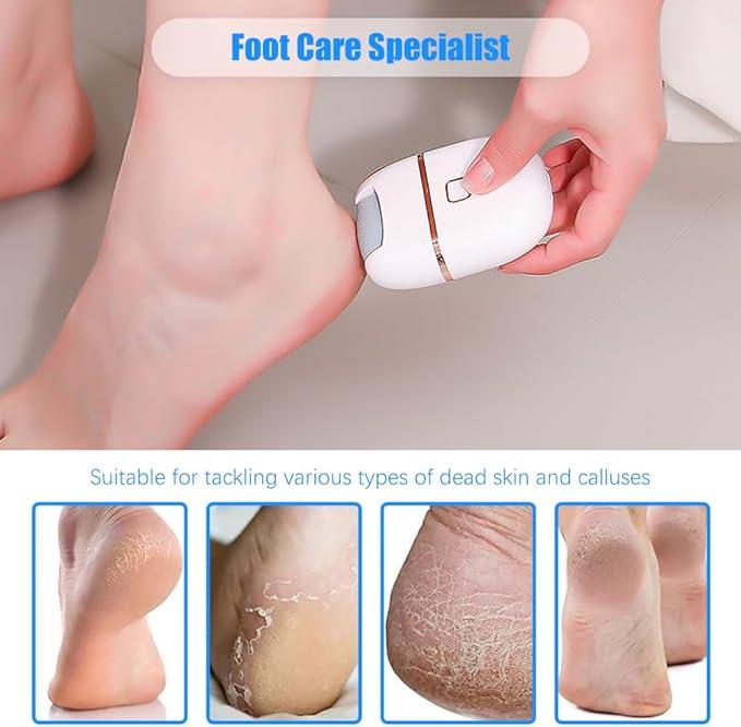 Electric Foot File Grinding Machine, Pressure Sensing Design, USB Rechargeable,Adjustable, Easy to Clean, Foot Repair and Grinding Device