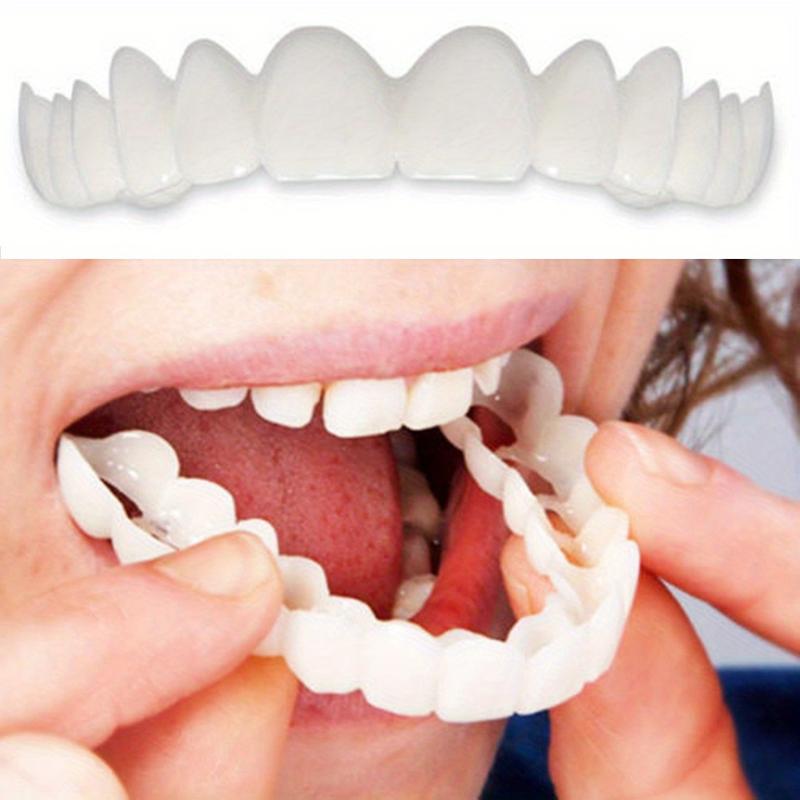 White Denture Veneer Set - Soft, BPA-Free, Adjustable Upper and Lower Denture Accessories for Men and Women - Easy to Clean, Comfortable, and Natural-Looking Smile adjustable buckle