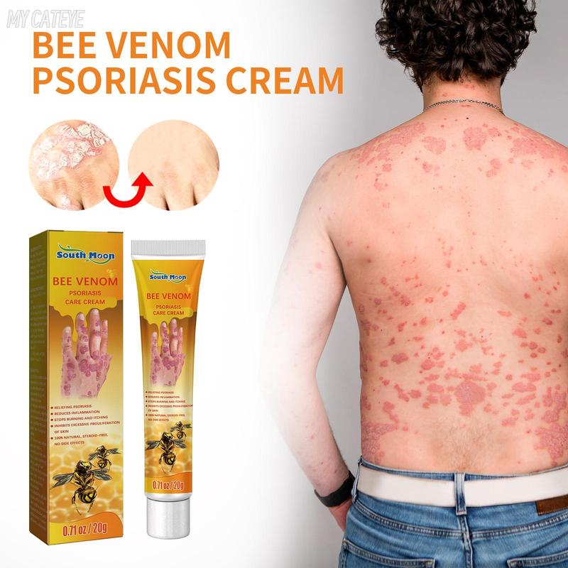 South Moon Bee Venom Psoriasis Cream, Relieve Itchy Skin Repair Hand Moss Moisturizing Skin Care Cream Nails Moisturizer glass rose bottle christmas 2024 ornament christmas